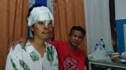 Dikeroyok di Parkiran Minimarket, Seorang Pemuda Diancam dengan Senjata Api