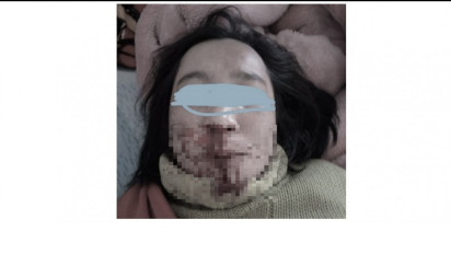 Ribut Masalah Harta, Oknum Polisi Aceh Tengah Bogem Kakak Kandung