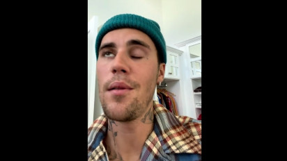 Justin Bieber Tunda Konser karena Wajahnya Lumpuh Sebelah