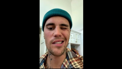 Apa Itu Ramsay Hunt Syndrome yang Buat Wajah Justin Bieber Lumpuh Separuh