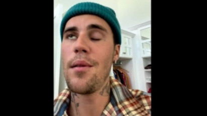 Kenali Gejala Sindrom Ramsay Hunt yang Sedang Diderita Justin Bieber, Telat Penanganan Bisa Berujung Fatal