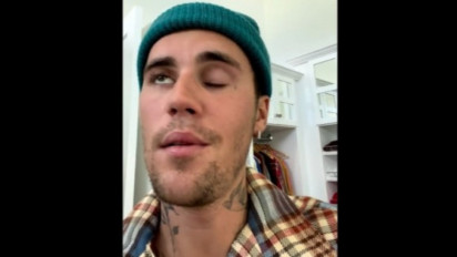 Justin Bieber Bagikan Kondisi Terkininya Usai Kabarkan Wajahnya Lumpuh Gegara Ramsay Hunt Syndrome, Sudah Membaik?