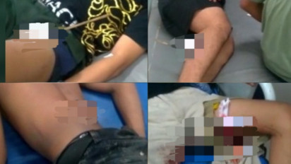 Enam Korban Bentrokan Pengantar Jenazah vs Massa di Perbatasan Makassar Maros masih dirawat di RSU Daya