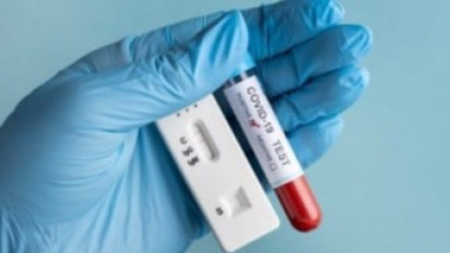 Pernah Terinfeksi Omicron, Lebih Rentan Terinfeksi Subvarian BA.4 dan BA.5