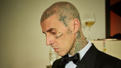 Dilarikan ke Rumah Sakit karena Derita Pankreatitis, Musisi Travis Barker Ungkapkan Penyebanya