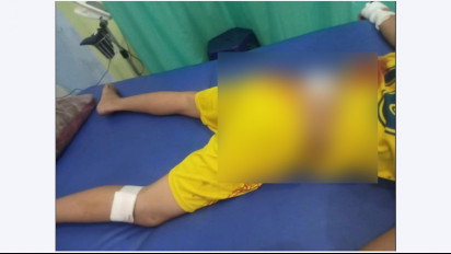 Gara-gara Sepele Bocah Nyaris Tewas Dianiaya Sekelompok Pemuda