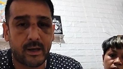 Suami Digebukin Lima Pegawai Kafe, Istri Claudio Martinez Sambangi Polda Metro Jaya Ogah Diajak Mediasi