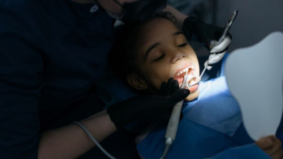 Siap-Siap Akan Terkena Ini Jika Tak Menjaga Kesehatan Gigi dan Mulut