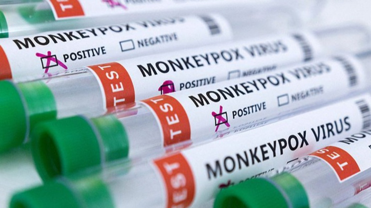 Fakta 'Ngeri' Cacar Monyet, dari Mana Berasal dan Cara Menanggulanginya?
            - galeri foto