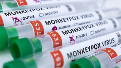 Fakta 'Ngeri' Cacar Monyet, dari Mana Berasal dan Cara Menanggulanginya?