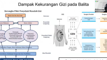Penjelasan Dokter Soal Bayi Prematur Berisiko Hingga Tiga Kali Lipat Menderita Stunting