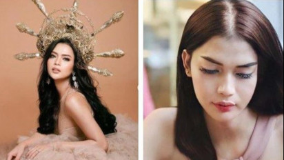 Dinda Syarif, Laki-laki Asal Cirebon yang Ubah Total Penampilan Jadi Perempuan Cantik, Buang Jakun Demi Tampil jadi Perempuan Seutuhnya