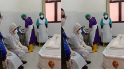 Otak Brigadir J Tak Ditemukan di Kepala, Malah Ada Bekas Tembakan yang Dilem Ternyata Tembus ke Hidung