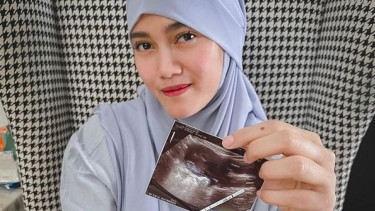 Jessie Amalia Unggah Hasil Test Pack dan USG, Netizen: Kapan Menikah?