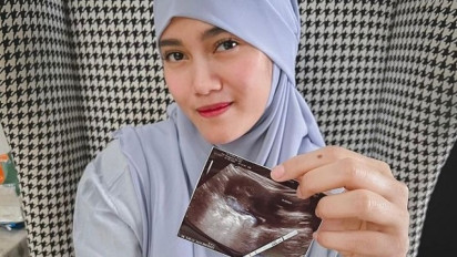 Jessie Amalia Unggah Hasil Test Pack dan USG, Netizen: Kapan Menikah?