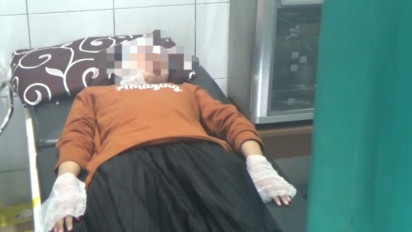 Diduga Alami Kebocoran, Sebuah Tabung Gas 3 Kg Keluarkan Api, Seorang Wanita Alami Luka Bakar