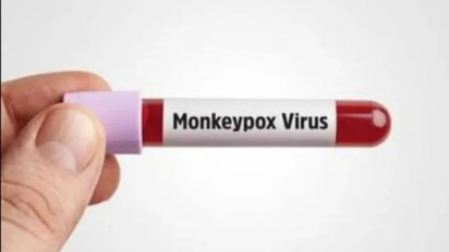 Cacar Monyet Sudah Terdeteksi di Indonesia, Kemenkes Minta Seluruh Dinkes Waspada