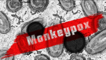 Masa Inkubasi Bisa Hingga 21 Hari, Ini Gejala Cacar Monyet yang Tak Hanya Ruam
