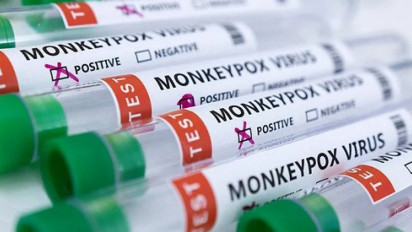 Sejarah Penyakit Cacar Monyet dan Bagaimana Penyebarannya dari Orang ke Orang?
