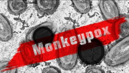 DKI Jakarta Kemasukan Cacar Monyet, Kenali Gejala Cacar Monyet, Bukan Cuma Ruam