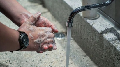 Rajin Cuci Tangan Bisa Bantu Cegah Terkena Cacar Monyet, Ini Penjelasan Pakar Kesehatan