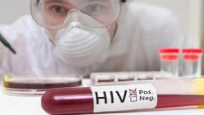 Ratusan Mahasiswa di Bandung Dikabarkan Positif HIV, Apa Saja Gejala yang Tampak dari Awal?