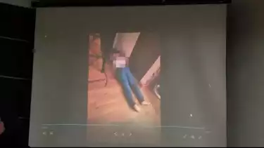 Terungkap, Foto Detail Jasad Brigadir J Detik-Detik Setelah Ditembak, Ada yang Aneh?