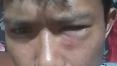 Main Hakim Sendiri, Seorang Pemuda Tersandung Hutang Piutang di Dumai Babak Belur Dihajar Pelaku