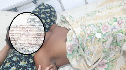 Tak Tahan Bertengkar dengan Istri, Suami di Aceh Tamiang Minum Racun Rumput