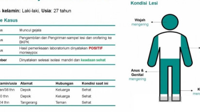 Kemenkes: Tiga Warga Kontak Erat dengan Pasien Cacar Monyet Dinyatakan Sehat