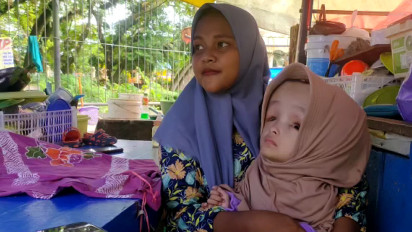 Kisah Putri Alexa, Bocah 4 Tahun Penderita Hidrosefalus