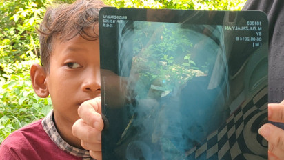 Karena Iseng, Anak Kecil Bermain Kunci Gembok Hingga Kunci Masuk ke Tenggorokan Selama Seminggu