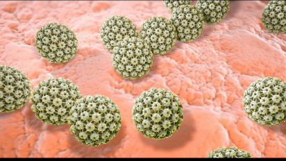 Hati-hati Wanita! Kanker Serviks Stadium Awal Tidak Ada Gejalanya Sama Sekali, Justru Banyak yang Baru Sadar ketika Kanker Sudah Menyebar