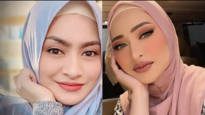Cerai dari Sule, Nathalie Holscher Malah Makin Cantik, Bibir Seksinya Tuai Sorotan Netizen: Cantik Banget, Mirip Aurel