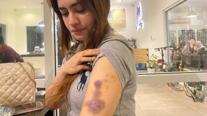 Viral, Wanita Cantik Babak Belur Dianiaya Oknum Polwan