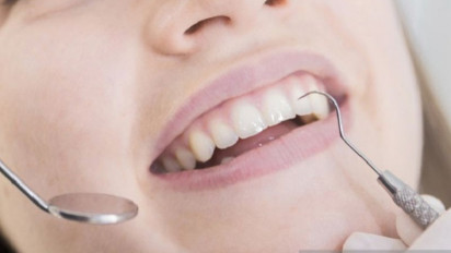 Nikotin Penyebab Gangguan Pertahanan Gusi Terhadap Bakteri? Ini Faktanya