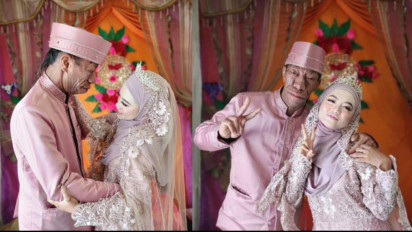 Viral Surya Manurung Pengidap Penyakit Langka ´Treacher Collins´ Menikahi Gadis Cantik, Netizen: Langgeng Sampai Akhir Hayat