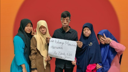 Disorot Netizen, Keluarga Manurung Mengidap Penyakit Langka ´Sindrom Treacher Collins´, Apa Itu dan Penyebabnya?