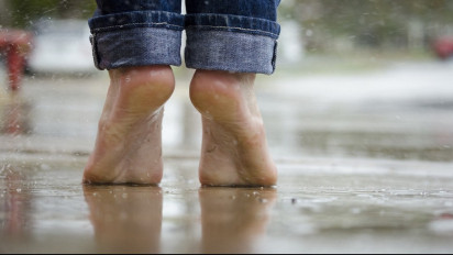 Bisa Dilihat dari Warna Kaki, Begini Tandanya Jika Kolesterol Tinggi