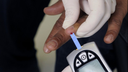 6 Ciri-Ciri Terkena Kolesterol, Nomor 3 Jarang Disadari