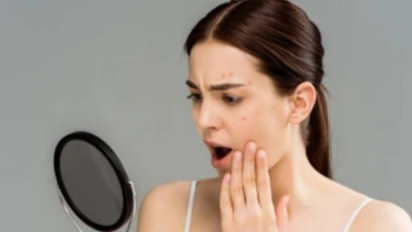 Ini Dia Bedanya "Purging" dan "Breakout" terhadap Produk Perawatan Kulit