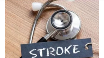 Waspadai, Dokter Ungkap Gaya Hidup Tidak Sehat Jadi Faktor Risiko Stroke di Usia Muda. Simak Saran Dokter