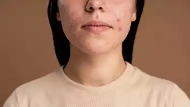 skincare tidak cocok