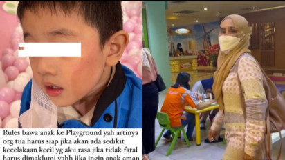 Viral! Emosi Anaknya Didorong Saat Bermain, Emak-Emak di Pontianak Tampar Anak Berusia 4 Tahun hingga Memar