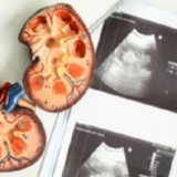 Stop Lakukan Ini saat Puasa! Ginjal Bisa Rusak Diam-Diam Tanpa Anda Sadari