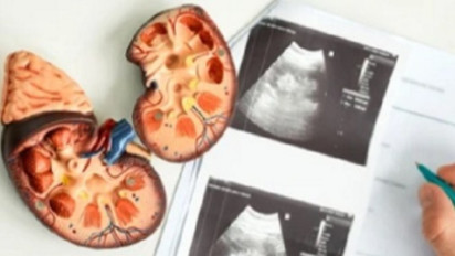 Stop Lakukan Ini saat Puasa! Ginjal Bisa Rusak Diam-Diam Tanpa Anda Sadari