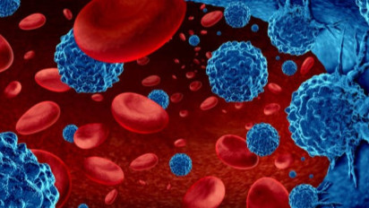 Jangan Sampai Stadium 3! Kenali 7 Gejala Kanker Kelenjar Getah Bening