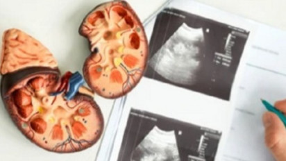 Posko Pengaduan Kasus Gagal Ginjal Akut Belum Terima Laporan, BPKN Imbau Korban Melapor