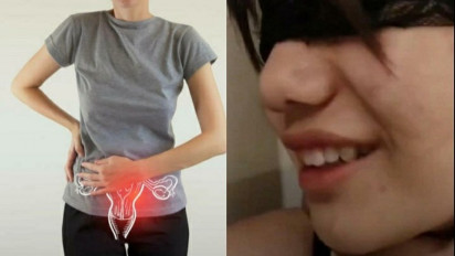 Mengerikan! Pemeran Video Wanita Kebaya Merah Bisa Diserang Penyakit Ini