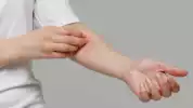 Dermatitis Atopik Masih Jadi Kasus Terbanyak pada Anak, Ini Penjelasan Ahli